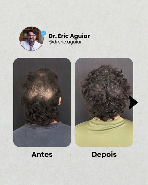 Por trás de cada antes e depois, existe muito mais do que estética.

Existe autoestima sendo reconst