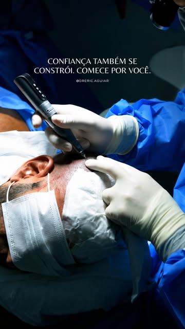 Hoje foi dia de transformar uma nova história. 
Realizamos um transplante capilar em um caso de calv
