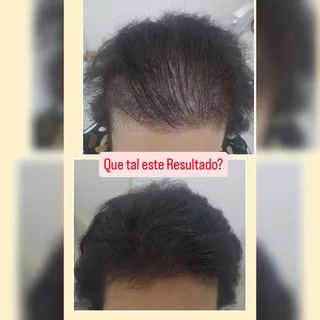 Venha tratar a Queda Capilar!