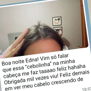 Paciente tinha Alopecia Areata