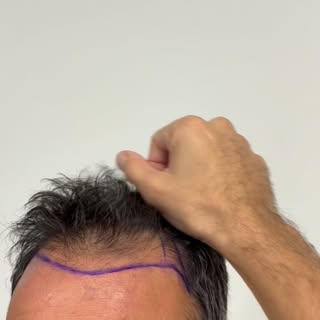 💇🏻‍♂️💇🏻‍♂️💇🏻‍♂️
