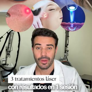 Tres tratamientos con láser que pueden conseguir resultados espectaculares en una sola sesión 👀✨

S
