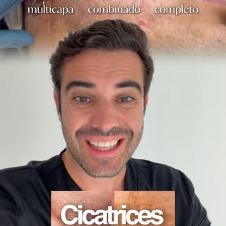 Tratamiento completo de cicatrices de acné complejas en clínica @abdermaclinica 

Comenta CICATRICES