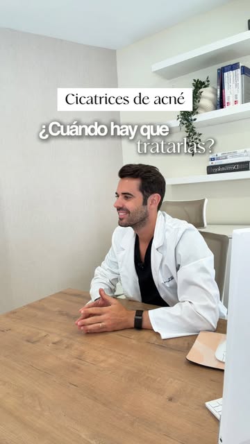 ¿Hay que esperar a terminar el tratamiento del acné para empezar a tratar las cicatrices? 👀

Idealm