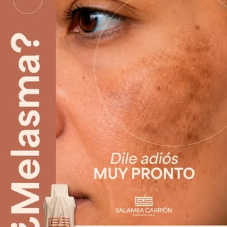 Una nueva tecnología está por llegar a Salamea Carrión Dermatología para ampliar las posibilidades d