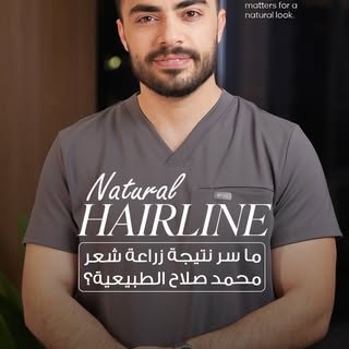 ⁨	نجاح زراعة الشعر لا يعتمد فقط على كثافة الشعر، بل على رسم خط الشعر بما يتناسب مع ملامح الوجه.

✨ ل