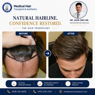 ✨ A Stronger Hairline. A New Level of Confidence.

Your hairline frames your face—and restoring it c