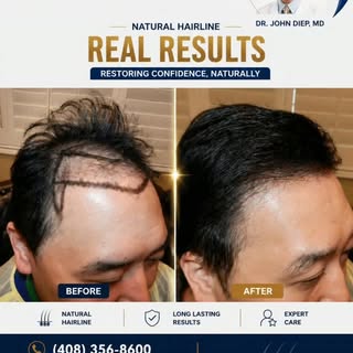 A natural-looking hairline can change everything. ✨

This before-and-after shows the difference that