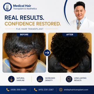 ✨ Real Results. Real Confidence. ✨

A stronger hairline can make a big difference in how you look an
