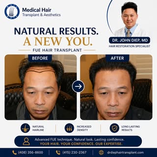 ✨ A Natural Hairline. A New Level of Confidence.

Hair loss doesn't have to define your future.

Thi