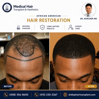Confidence starts with your hairline.

This patient wanted a fuller, natural-looking hairline that c