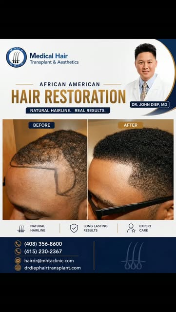 A Fuller Hairline. A Renewed Confidence. ✨

African American hair requires specialized care and expe