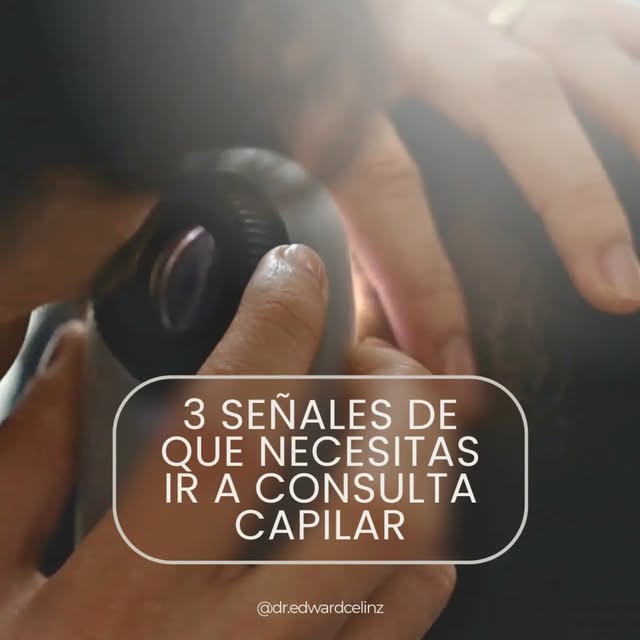Tu cabello no cambia de un día para otro. Por eso, esperar a que la pérdida sea evidente puede signi