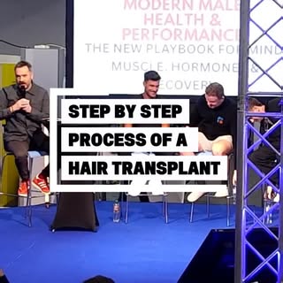 Thinking about a hair transplant but don’t know where to start?⁠
⁠
Paul Edwards from @growcluboffici