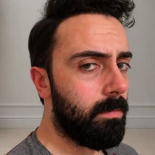 Another stunning result from the Growclub team. It never ceases to amazing me how a new hairline ref