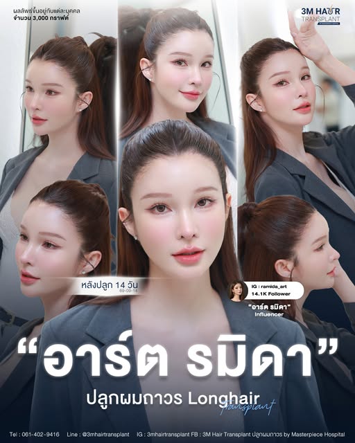 ครบ 14 วัน "รมิดา นางฟ้าอ่าวไทย" ปลูกผม long hair ไม่ว่าจะทรงไหนก็สวยเป๊ะ ไม่โป๊ะ ❤️ @ramida_art 

ต