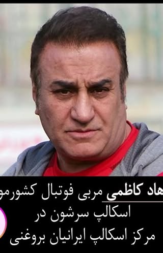 رفع کم پشتی مو، ممنونیم از آقای فرهاد_کاظمی مربی فوتبال کشورمون  که مرکز ما رو برای اسکالپ سر انتخاب