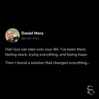 SMP brought back my hairline (and confidence) - now I help other guys do the same.

Message me "SMP"