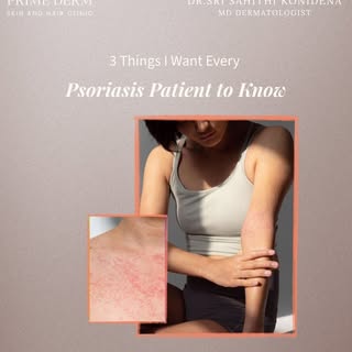 Living with psoriasis? Save this one. 🤍

Psoriasis is manageable, but it often needs long-term care