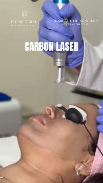 A closer look at Carbon Laser. ✨
Deep cleansing, exfoliation and targeted skin rejuvenation — all in