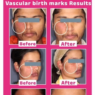 Simple beauty rest, clear skin
.
.
#drswapnilshahclinic #skincareproduct #smoothskin #skindoctorindi