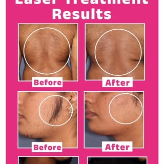 Time to glow with confidence
#drswapnilshahclinic #skindoctorindia #skincareproduct #smoothskin #sol
