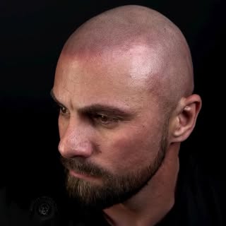 🔥 BEFORE AND AFTER Scalp Micropigmentation 

This is a before and after video of scalp micropigment