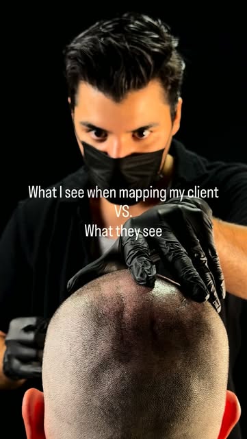 Guys, is this how it feels? 👁️👄👁️

What I see vs ✍️📐
what my client sees 👁️👄👁️

#scalpmicropi