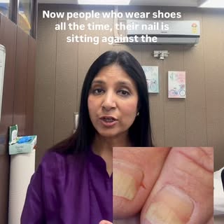 Onycholysis #nail #onycholysis
