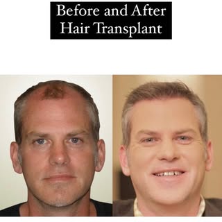 Restore your CONFIDENCE @pai.medicalregina