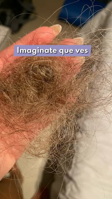 ¿Tenés mucha caída de pelo y empezaste a espaciar los lavados? 👀

Eso fue exactamente lo que hizo e