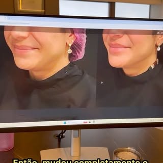 Quem aí também quer um contorno definido? 👀✨