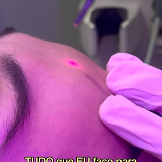 Quem quer suavizar as rugas sem ficar com “cara de Botox”? 👀
