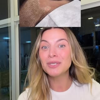 Quais desses aparelhos vocês já fizeram? ✨