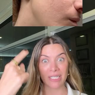 Conhece alguém que sofre com isso também? 
Compartilha esse vídeo com ela ✨
