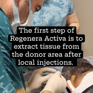 Three samples of skin tissue are collected from the donor (occipital) area as it is considered safe 