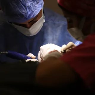 FUE facts: Harvesting Part 1

In FUE hair transplant, we harvest the grafts from the back and sides 
