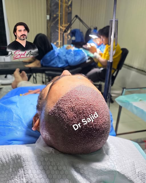 Perfection plus cleanness, Design with Dr Sajid. Your ultimate hair transplant Surgeon