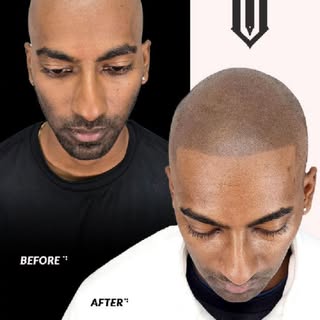 Confidence hits different when your reflection matches how you feel inside.
This SMP transformation 
