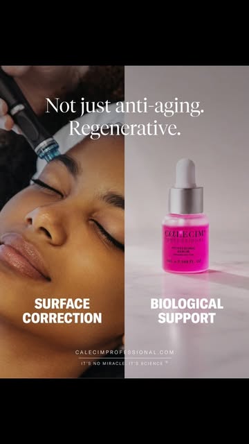 LIMITED PACKAGES NOW LIVE … I’ve had A LOT of questions about my microneedling post… so here’s exact