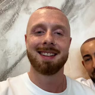 Hair Transplant Operation ✨