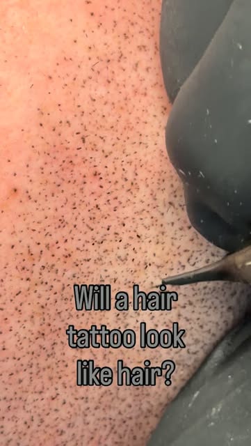 Will a hair tattoo look like real hair?
Depends what you mean by “hair.”
SMP (scalp micropigmentatio