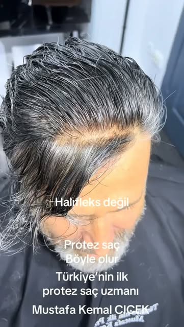 #mustafakemalçiçek #protezsaçmerkezi #protezsaçbakımı #protezsaçuygulaması #protezsaçmodelleri