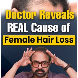Women Hair Loss? Find the Cause Before a Hair Transplant! 

Female hair loss should not always be tr