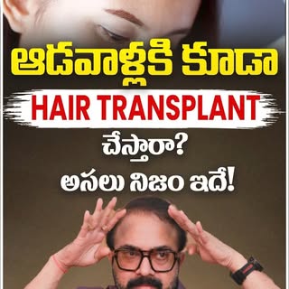 Can Women Get a Hair Transplant? Here's the Truth! | Female Hair Transplant in Telugu | Dr. Rajasekh