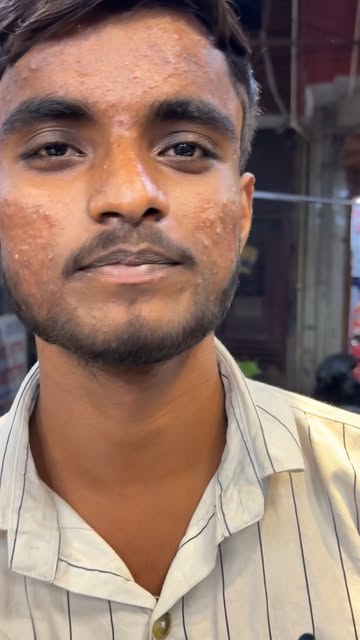 Satisfied Customer 💯

📞 Order Now: +91 9810622372
🌐 Website: www.sharmapharmacy.com

#SkinTreatme
