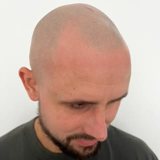 Bringing back a fuller hairline! 👩🏼‍🎨