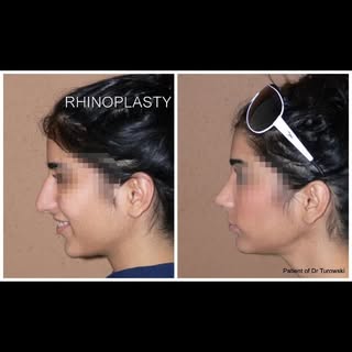 #chicagotopdoc #chicagoplasticsurgeon #chicagobeautyspecials #chicagotopsurgeon #chicagogirls #chica