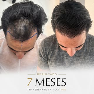 ⚜️ A evolução acontece mês após mês. E, aos 7 meses, este resultado já demonstra uma mudança signifi