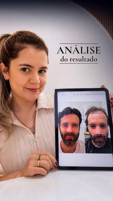 ⚜️O resultado de 12 meses: o que eu observo nesse caso?
Hoje quero comentar um pouco mais sobre o re